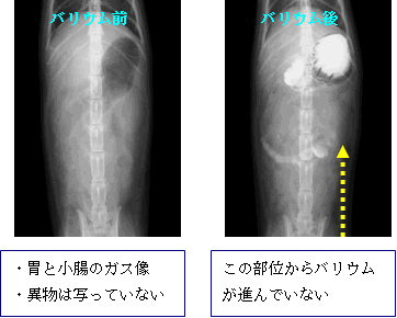 消化器疾患　レントゲン写真